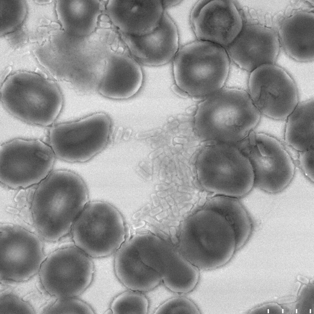 pôle maladies infectieuses